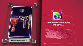 Nephritic syndrome [upl. by Hilton]