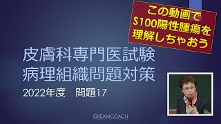 皮膚科専門医試験問題の解説 2022年度問題17 [upl. by Rohn]