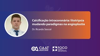 Calcificação intracoronária litotripsia mudando paradigmas na angioplastia [upl. by Stoneman]