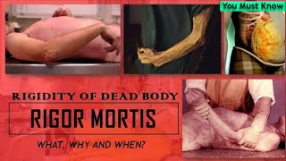 Rigor Mortis  Rigidity of the Dead Body  Early Changes  Thanatology  You Must Know [upl. by Edholm62]