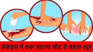 कट जाने पर या चोट लगने पर बहते हुये खून तुरंत को रोकने के उपाय  Stop Bleeding Immediately [upl. by Nereen]