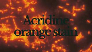 Acridine Orange Staining  Principle Method and Result [upl. by Atirahs849]