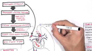 Pulmonary Embolism PART I Overview [upl. by Cristi208]