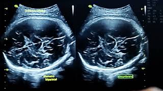 38 SEMANAS CONTRACCIONES UTERINAS UNA BEBÉ LISTA PARA CONOCER EL MUNDO 🌍 [upl. by O'Donnell]