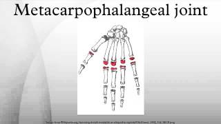 Metacarpophalangeal joint [upl. by Fidellia]