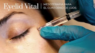 Eyelid Vital la mesoterapia indolora para el contorno de ojos [upl. by Soracco883]