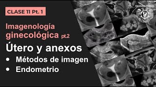 111  Imagen Ginecológica Métodos de estudio y patología endometrial [upl. by Kreitman186]