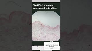 Stratified Squamous Keratinised Epithelium [upl. by Ybrad207]