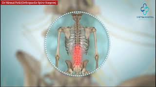 Lumbar canal stenosis spinalstenosis lumberlordosis backbonesurgery [upl. by Letisha]