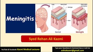 Meningitis  Neurology  Pediatric Review  KML [upl. by Adina507]