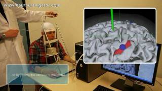 NeuralNavigatorcom demonstration [upl. by Retseh]