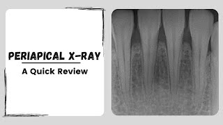 Periapical x ray  Intraoral Dental Radiograph [upl. by Salzhauer]