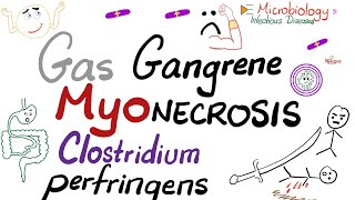 Gas gangrene amp Myonecrosis  Clostridium perfringens [upl. by Jillayne]