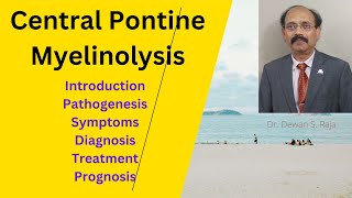 Central Pontine Myelinolysis [upl. by Keven]