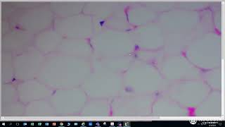 Anatomy amp Physiology 1 Loose Connective Tissue  Adipose Connective Tissue [upl. by Hsak]