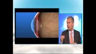 Glaucoma En qué consiste  Dr Castillo [upl. by Kehr]