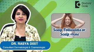 ACNE OR PIMPLES ON SCALP  Scalp Folliculitis  Causes amp Treatment DrRasya Dixit  Doctors Circle [upl. by Doxia]