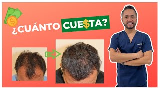 💵🤑¿Cuánto Cuesta un TRASPLANTE DE CABELLO en México [upl. by Amaryl]