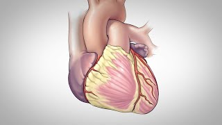 Coronary Artery Bypass Surgery [upl. by Lisle885]