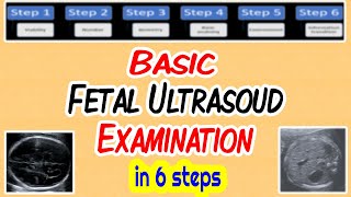 Basic Fetal Ultrasound Examination [upl. by Itsud]