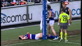 Tom Campbell vs the goalpost  AFL [upl. by Wendy]