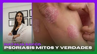 PSORIASIS  ¿Cómo se diagnostica [upl. by Nnaael]