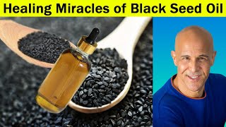 Healing Miracles of Black Seed Oil with Dr Mandell Live Chat Stream [upl. by Odlareg]