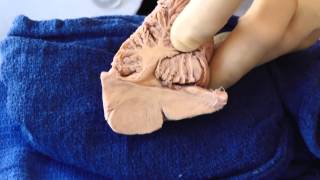 Control of the Eye Movements Neuroanatomy Video Lab  Brain Dissections [upl. by Mairam116]