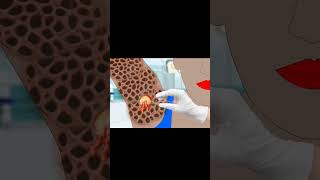 ASMR Removal Dog Ticks amp Maggot Infected  Severely Injured Animation1 [upl. by Reifel]