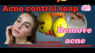 How too remove your Acne Acne control soap acne km krny ka treeka Best soap for pimples [upl. by Christabel]