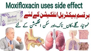 moxifloxacin 400 mg uses in urdu moxifloxacin 400 mg  Mofest 400mg  X gen 400mg  Avelox 400mg [upl. by Einneg]