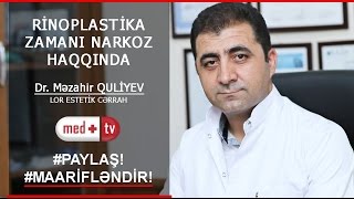 RINOPLASTIKA BURUN EMELIYYATI NARKOZ HAQQINDA  DR Mezahir QULIYEV LORCERRAH [upl. by Esme]