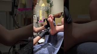 If you have back pain Try Cupping therapy once massage xuhuong cupping Giachoi asmr viral [upl. by Baldwin15]