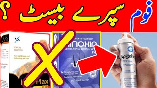 Rogaine Foam Spray 100 Result  How To Apply Monxidil Spray [upl. by Alaecim]