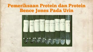 PEMERIKSAAN PROTEIN DAN PROTEIN BENCE JONES PADA URINE [upl. by Mal]