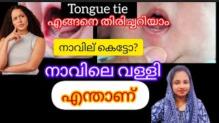 എന്താണ് നാക്കിലെ കെട്ട് നാവിലെ വള്ളി tongue tie എങ്ങനെ തിരിച്ചറിയാം tongue tie malayalam [upl. by Haveman]