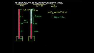 ESR made easy  Erythrocyte Sedimentation Rate  Full Blood Count Masterclass series [upl. by Yennej]