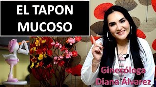 TAPON MUCOSO POR GINECOLOGA DIANA ALVAREZ [upl. by Indihar]