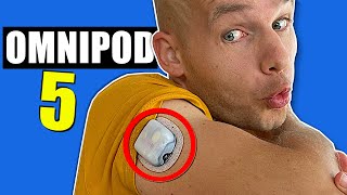 Omnipod 5  Full Review  This is it [upl. by Shae899]