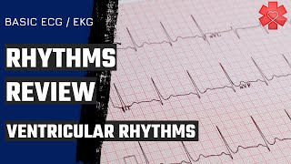 Basic ECG EKG Part 4 Ventricular Rhythms [upl. by Rosemarie]