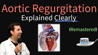 Aortic Regurgitation Aortic Insufficiency Explained Clearly  Remastered [upl. by Etnauj571]