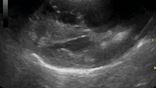 Echocardiography canine Angiostrongylus with pulmonary hypertension [upl. by Reine]