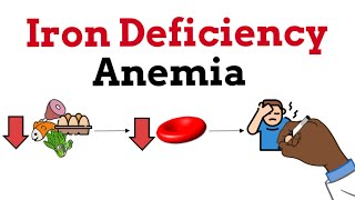 Iron Deficiency Anemia SIMPLE BREAKDOWN [upl. by Karil]