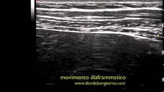 movimento diaframmatico  DIAFRAGMATIC MOVEMENT FUSAE APPROACH [upl. by Tatiania626]