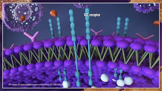 Is It Systemic Mastocytosis Best Practices for Diagnosis and Management [upl. by Eleirbag]