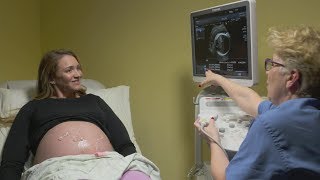 Ultrasounds during pregnancy [upl. by Roer]