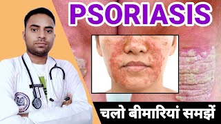 psoriasis kya hai how to treat psoriasis ❤️💥💯 raheesansari [upl. by Eal]