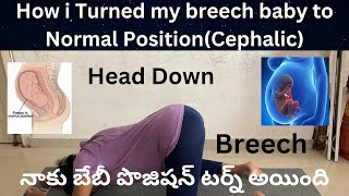 How i turned my breech baby to Normal positionCephalic pregnancy viralvideo [upl. by Jacinta]