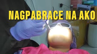 NAGPALAGAY AKO NG BRACES SUPRISING Aksel at nabundol pa ako ng tricykle [upl. by Aicnilav]