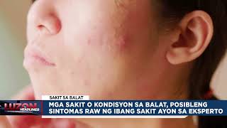 Mga sakit o kondisyon sa balat posibleng sintomas raw ng ibang sakit ayon sa eksperto [upl. by Reinar]